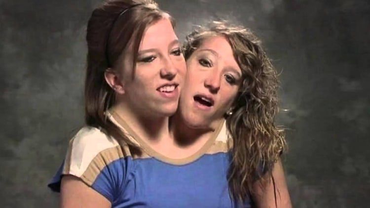10 adolescentes que chocaram o mundo com suas diferenças! Quotes